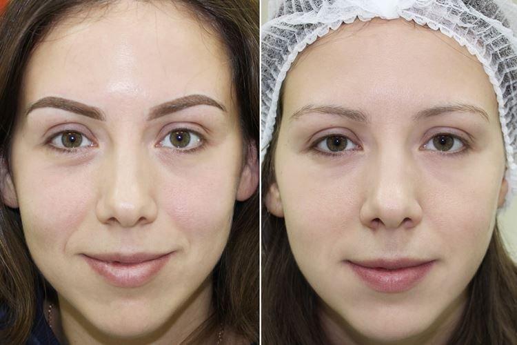 Maquillage permanent des sourcils - photos avant et après