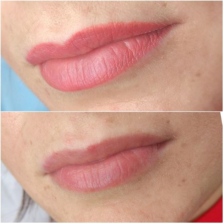 Maquillage permanent des lèvres - photos avant et après