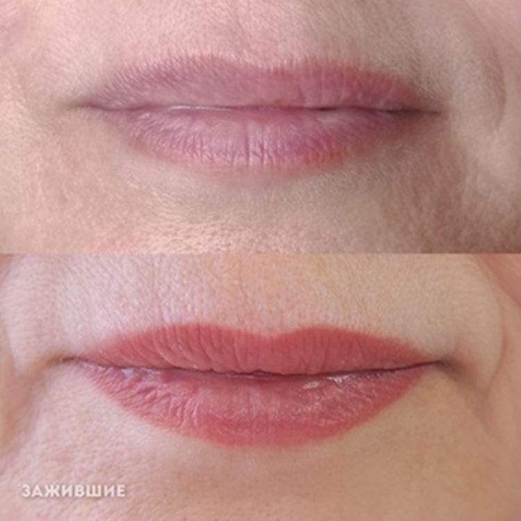 Maquillage permanent des lèvres - photos avant et après