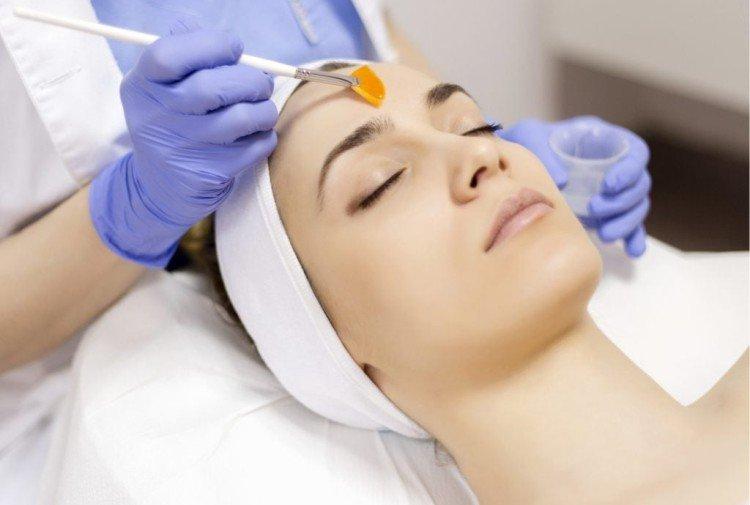 Inconvénients - Peeling du visage