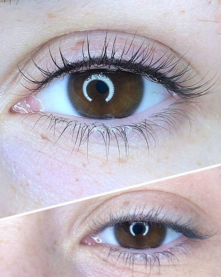 Tatouage des yeux - photos avant et après