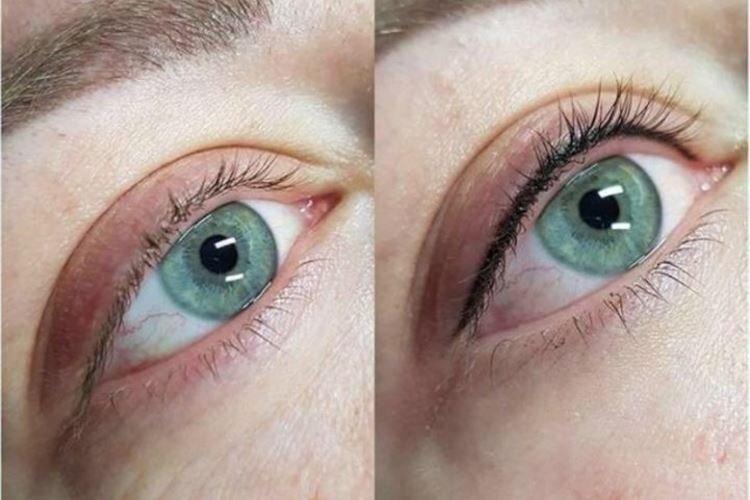 Tatouage des yeux - photos avant et après