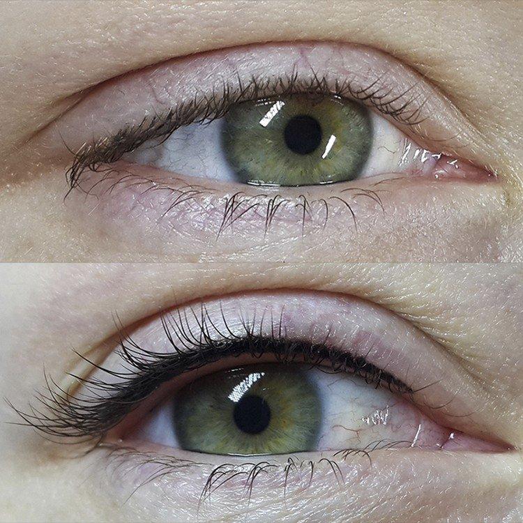 Tatouage des yeux - photos avant et après