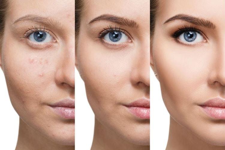 Ton inégal - Erreurs de maquillage du soir