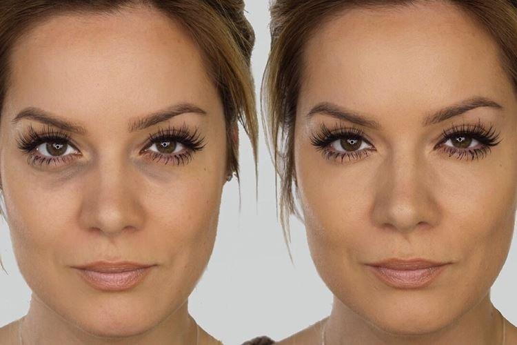 Cernes sous les yeux - Erreurs de maquillage du soir